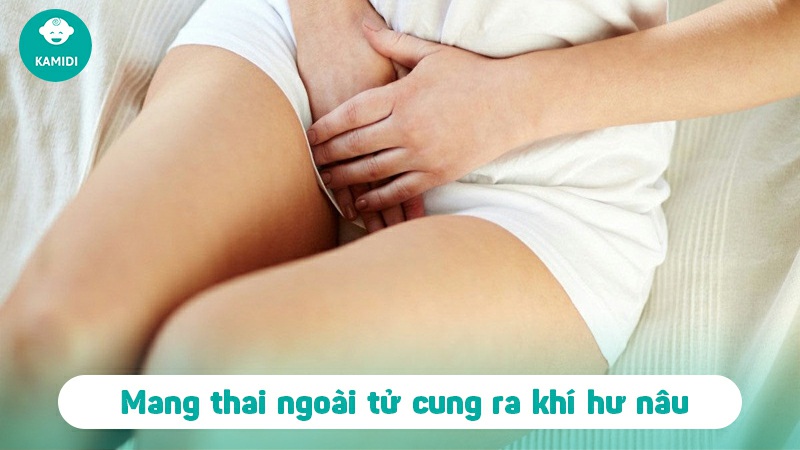 Ra khí hư màu nâu có phải có thai không? 3 ra-khi-hu-mau-nau-co-phai-co-thai-khong-2