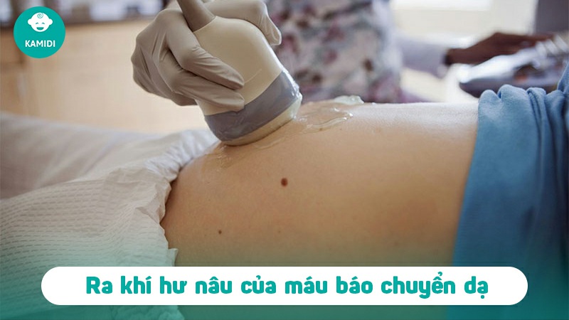 Ra khí hư màu nâu có phải có thai không? 4 ra-khi-hu-mau-nau-co-phai-co-thai-khong-3