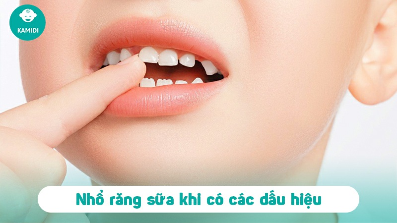 Răng sữa lung lay bao lâu thì nhổ? Cách nhổ răng sữa an toàn, không đau cho bé 3 rang-sua-lung-lay-bao-lau-thi-nho-2