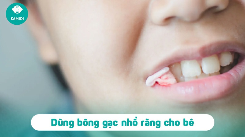 Răng sữa lung lay bao lâu thì nhổ? Cách nhổ răng sữa an toàn, không đau cho bé 5 rang-sua-lung-lay-bao-lau-thi-nho-4