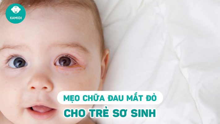 meo-chua-dau-mat-do-cho-tre-so-sinh