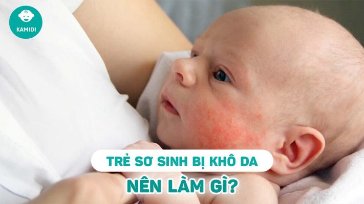 tre-so-sinh-bi-kho-da