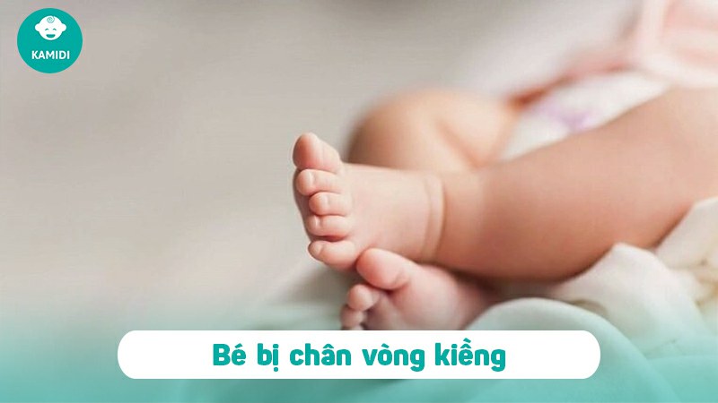 dong-bim-cho-tre-so-sinh-co-bi-vong-kieng-khong-1