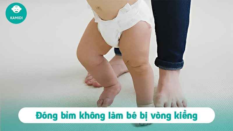 dong-bim-cho-tre-so-sinh-co-bi-vong-kieng-khong-2