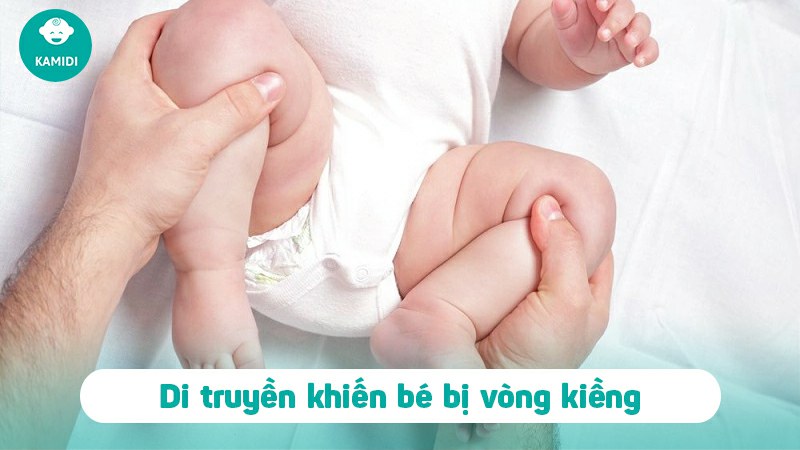 dong-bim-cho-tre-so-sinh-co-bi-vong-kieng-khong-3