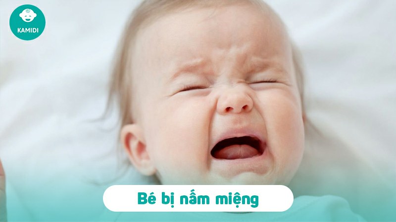 Trẻ bị nấm miệng: Nguyên nhân, dấu hiệu và cách khắc phục 2 tre-bi-nam-mieng-1