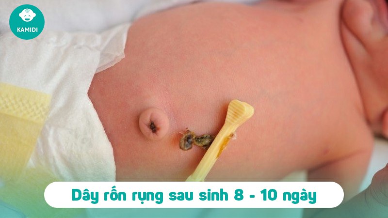 Quá trình rụng rốn ở trẻ sơ sinh, hình ảnh rụng rốn ở trẻ sơ sinh ba mẹ cần lưu ý 3 rung-ron-o-tre-so-sinh-2