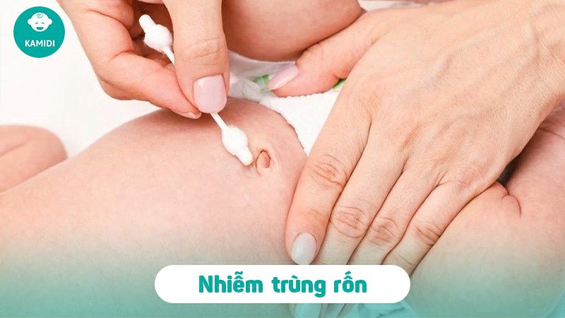 Quá trình rụng rốn ở trẻ sơ sinh, hình ảnh rụng rốn ở trẻ sơ sinh ba mẹ cần lưu ý 5 rung-ron-o-tre-so-sinh-4