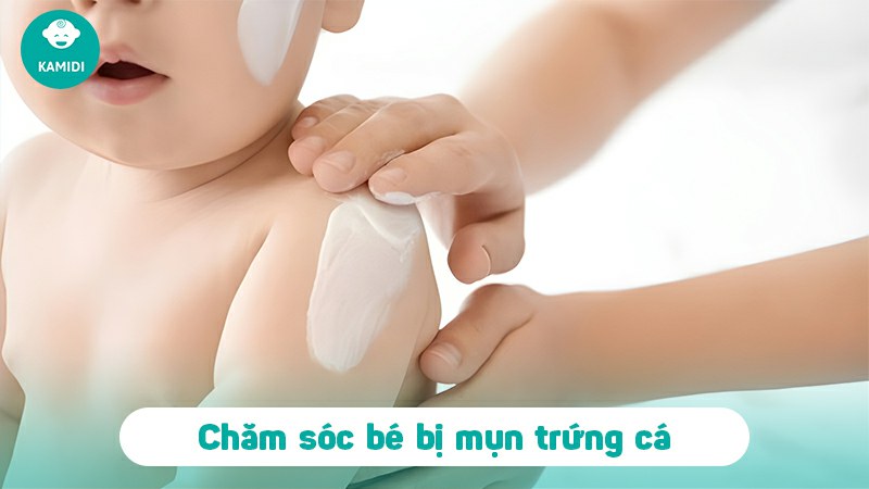 Mụn trứng cá ở trẻ sơ sinh có nguy hiểm không? Nguyên nhân và cách điều trị 6 mun-trung-ca-o-tre-so-sinh-5
