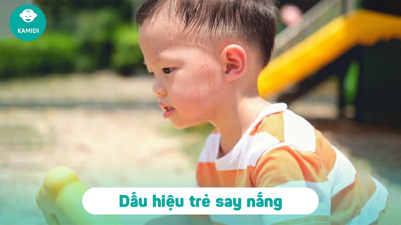 Dấu hiệu trẻ bị say nắng và cảm nóng ba mẹ nên biết 2 dau-hieu-tre-bi-say-nang-1