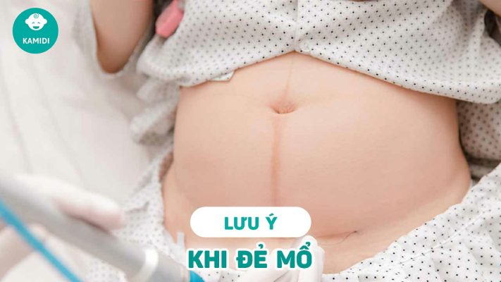 nhung-luu-y-khi-de-mo