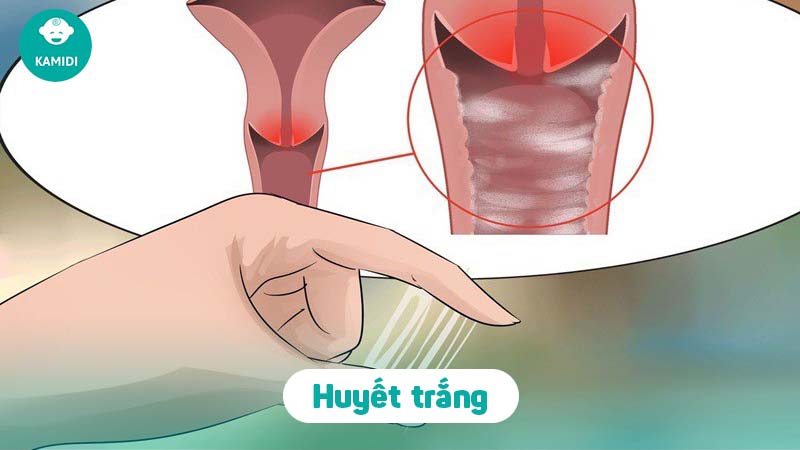 Mách mẹ cách nhận biết nước ối và huyết trắng chính xác nhất 2 cach-nhan-biet-nuoc-oi-va-huyet-trang-1