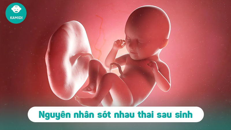 Sót nhau thai sau sinh: Nguyên nhân, triệu chứng và cách điều trị 2 sot-nhau-thai-sau-sinh-1