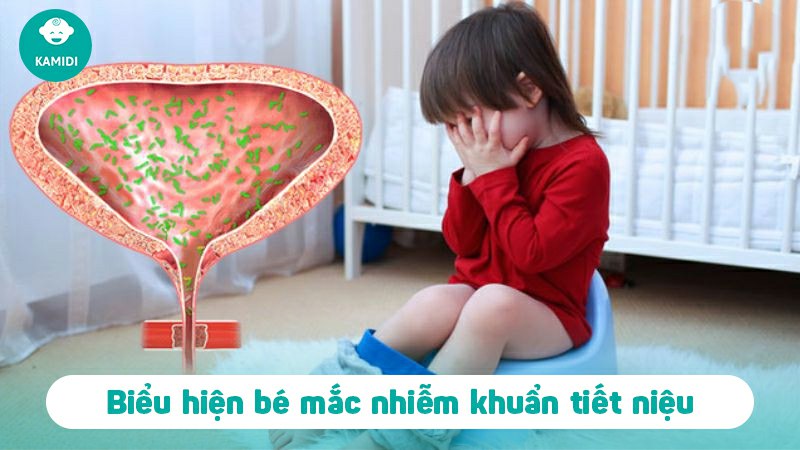 Nhiễm khuẩn tiết niệu ở trẻ em: Nguyên nhân và biểu hiện bệnh 5 nhiem-khuan-tiet-nieu-o-tre-em-4