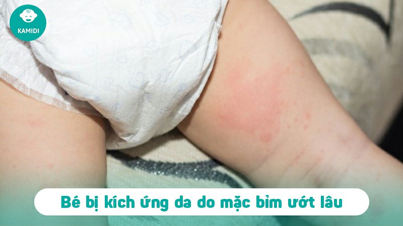 Tại sao trẻ sơ sinh khóc khi thay bỉm? Gợi ý ba mẹ cách xử lý 3 tai-sao-tre-so-sinh-khoc-khi-thay-bim-2