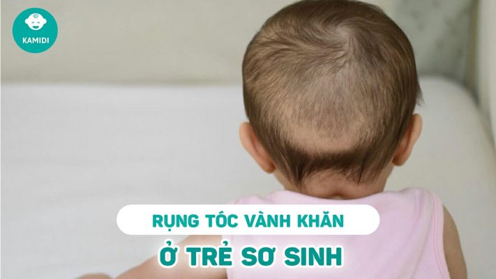 rung-toc-vanh-khan-o-tre-so-sinh