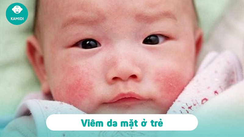 nhiem-trung-da-o-tre-so-sinh-3