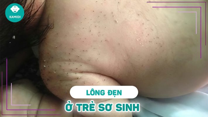 long-den-o-tre-so-sinh